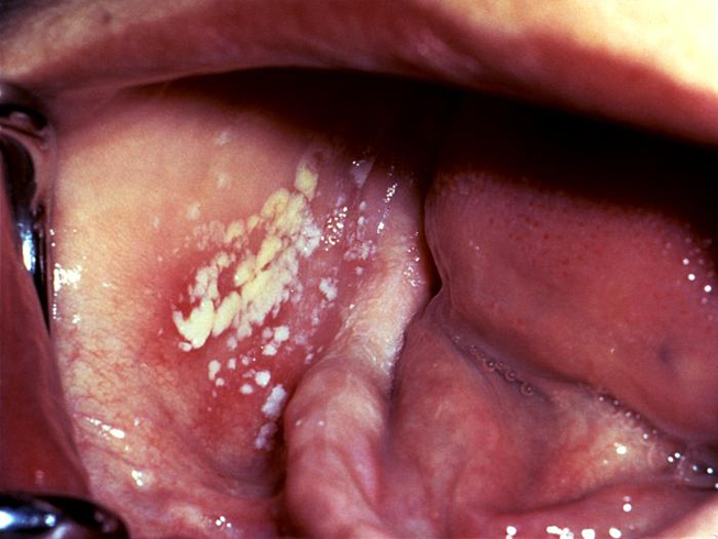 aids on a pussy Girl giving pleasure to guy